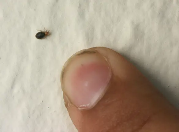 bed bug from hugging someone